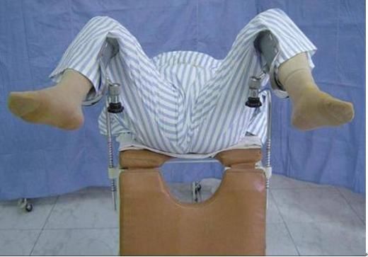 治疗痔疮不手术,给你2份消痔神方,在家就能撵