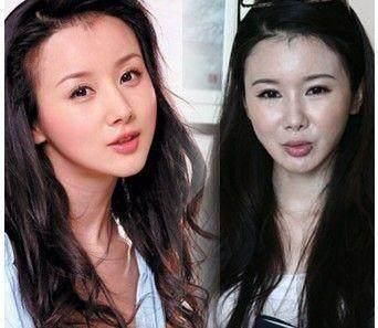 整容最失败的三位女星,越整越丑,哪个是你曾经喜欢的女神?