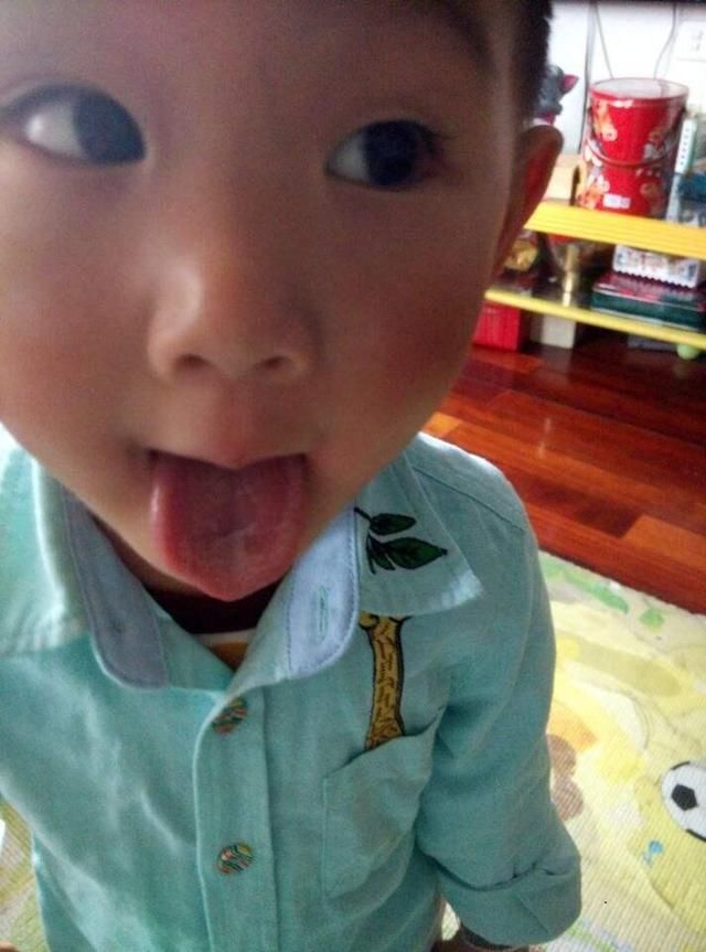 宝宝经常流口水,舌苔有地图舌,给孩子熬点汤和