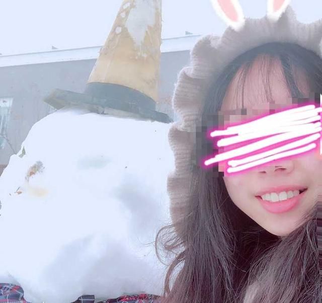 牙套小萌新的整牙日记:龅牙,短下巴,拔四颗牙