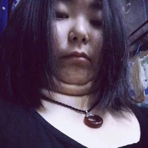 维生素E加蜂蜜,睡前涂脸,10分钟祛斑黑色素掉