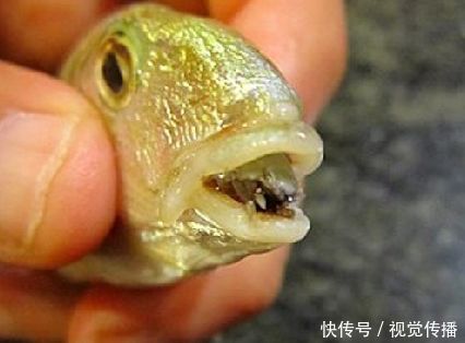 少女旅游归来肚子痛持续6年,最终被查出原因,