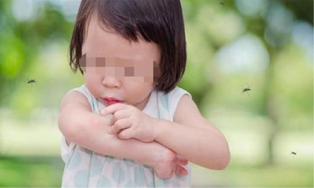 夏季孩子身上常出现很痒的包,并不都是蚊子咬