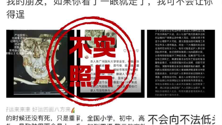 网传邯郸初中生遇害案颅骨照片不实 网传邯郸初中生遇害案颅骨照片不实