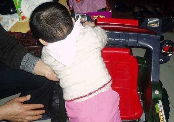 3岁宝宝双眼充血全身皮疹脱皮,被确诊川崎病,