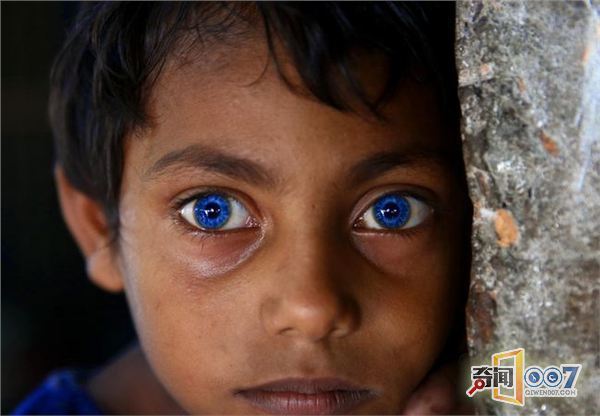 奇特!男孩生诡异蓝宝石眼睛,恍如玄幻电影走出来的! 奇特!男孩生诡异蓝宝石眼睛,恍如玄幻电影走出来的!