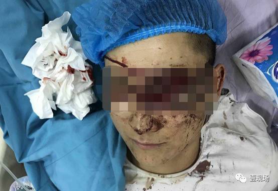 女司机鸣了声喇叭 遭12名醉酒保安持钢管围殴