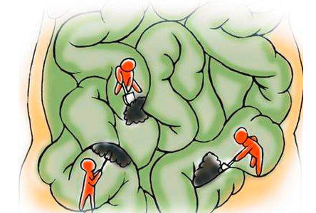 为什么会长铜钱癣?老中医有绝招