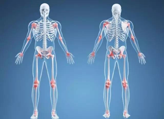 运动关节中怎么会出现嘎嘎的响声?这是不是关节炎前兆?