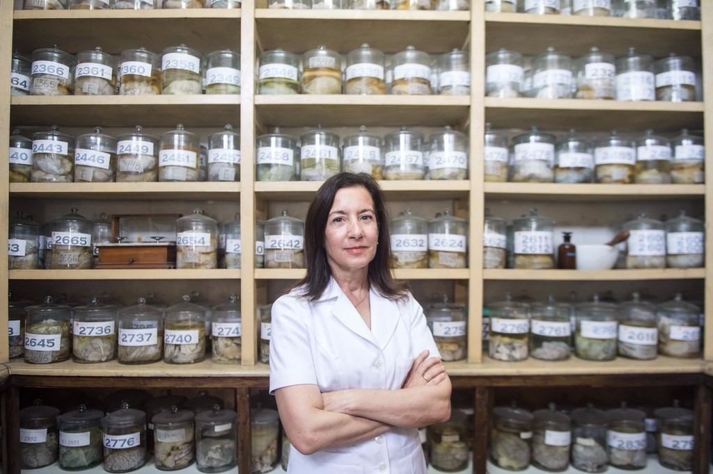 胆小慎入!探访秘鲁大脑标本博物馆揭秘人体秘密