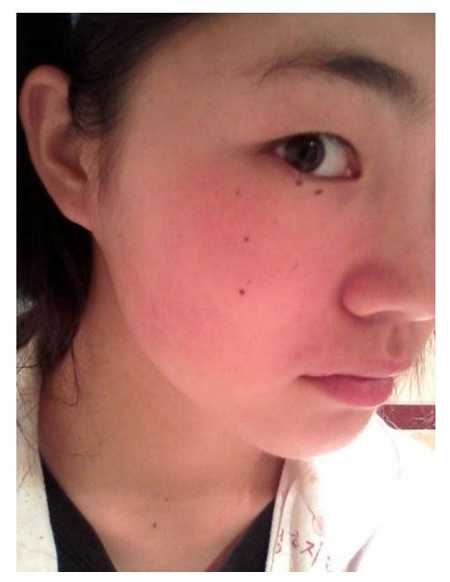 邻家小姐姐偶用蜂蜜掺它涂脸,7天击退十几年斑