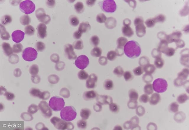 出现这些症状是白血病的前兆吗