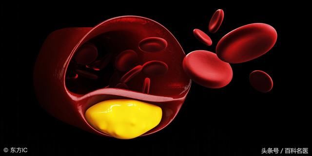 成年人睡觉还流口水?当心这种病!