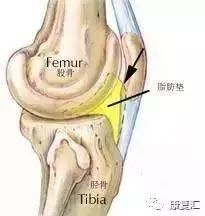 如何搞定膝盖疼