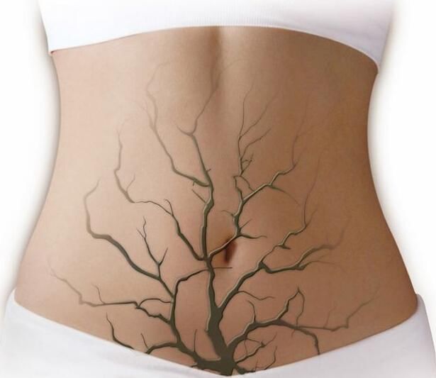 惨痛教训!毛孔粗大、长闭口,粉底这个雷区还有