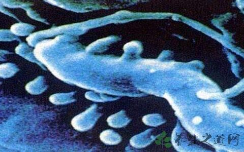 幽门螺旋杆菌传播方式