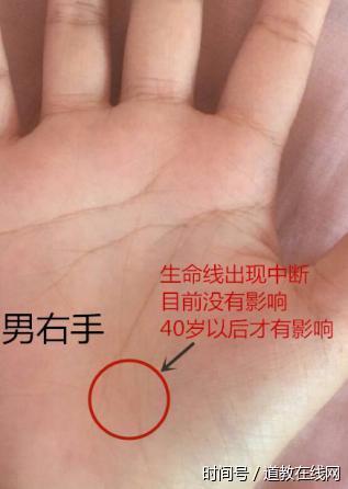 此线断开，不管男女，四十岁之后定有一灾