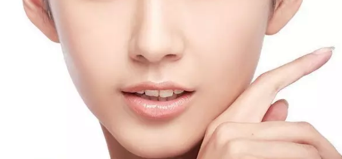 解析鼻翼整形常见四种术式