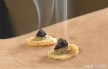 阳气损耗过多百病生,冬天艾灸这两大穴位补阳