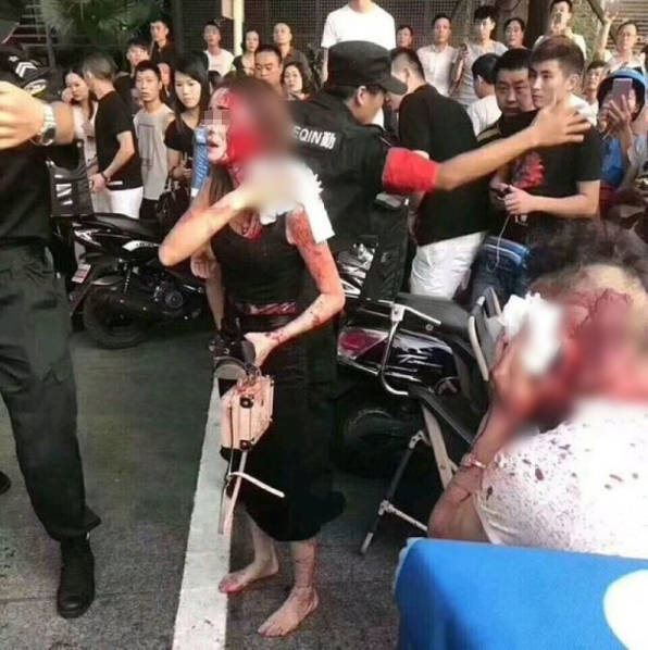 重庆江北区9月11日晚发生持刀伤人案，一男一女于观音桥某商场外被斩伤。据目击者表示，两名伤者逛街时突遭一名中年男子追斩，双方在街头扭作一团，鲜血遍地。疑犯伤人后未即时逃离现场，多名警察接报持长棍到场，并将其压制在地。来源：重庆晨报