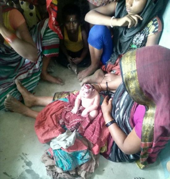 印度女子产下无脑巨眼怪婴 当地人奉若神明