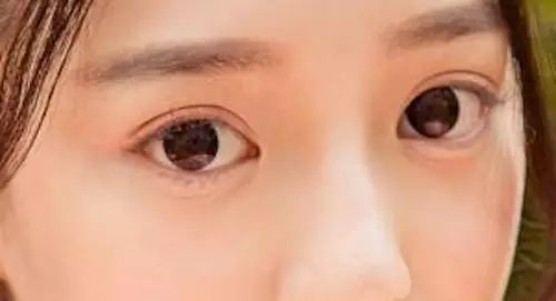 面相:眼睛形状,看一个人的富贵