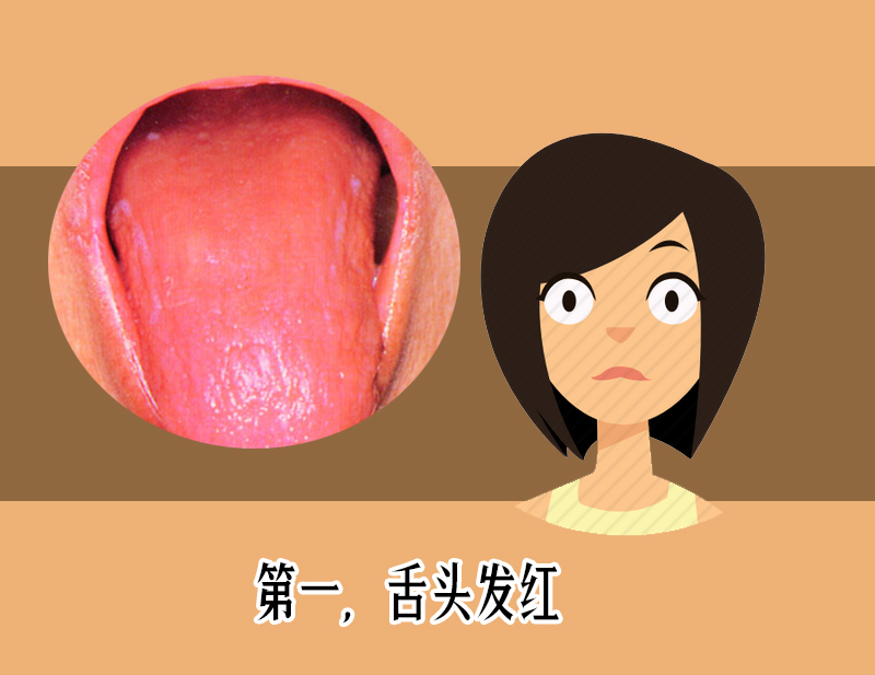 舌苔发红发黑是疾病警告?医生教你如何从舌头