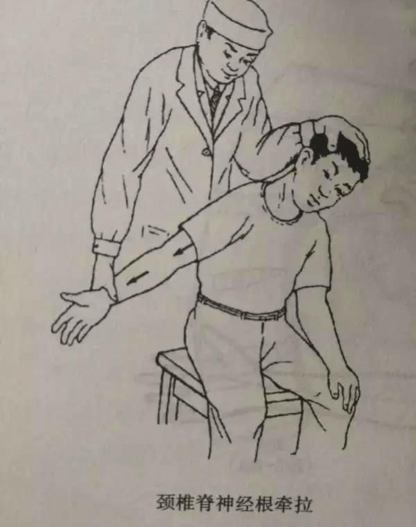 脖子僵硬酸胀不是颈椎病,那是怎么了