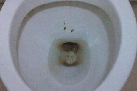 大便总是粘马桶,感觉解不净?老中医秘方一周就