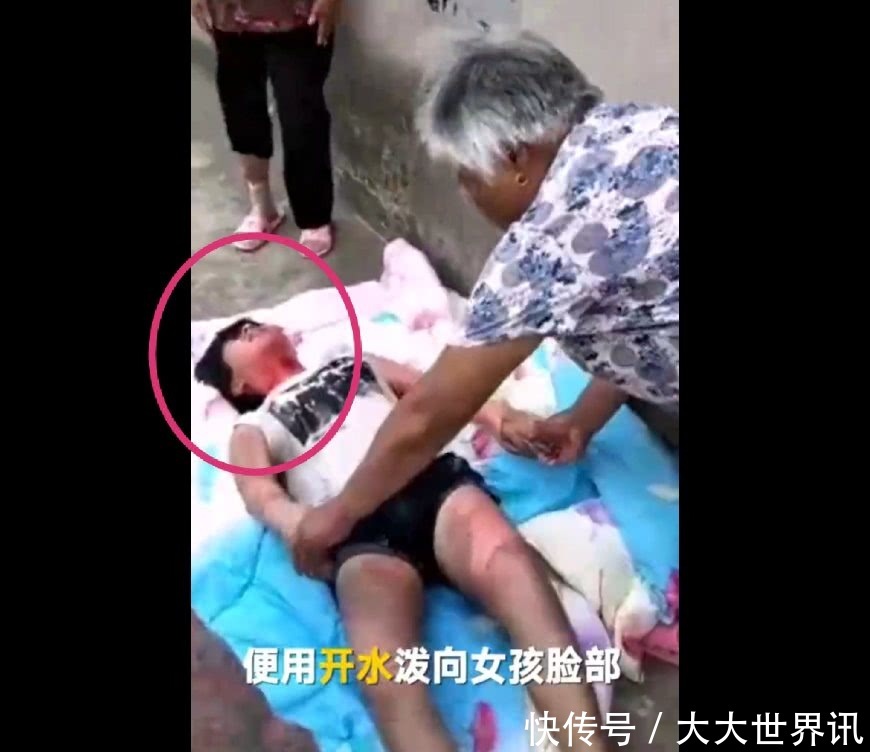 母亲与人私奔,17岁女孩遭对方妻子报复,被开水