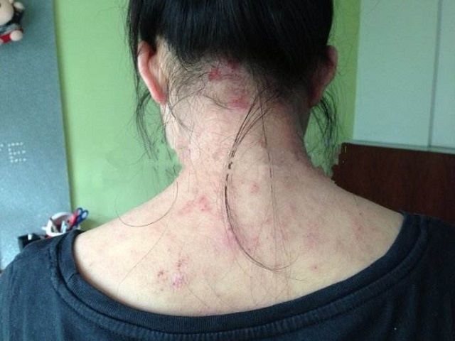 老中医:桂圆加生姜一起泡水喝,连喝几天,湿气就