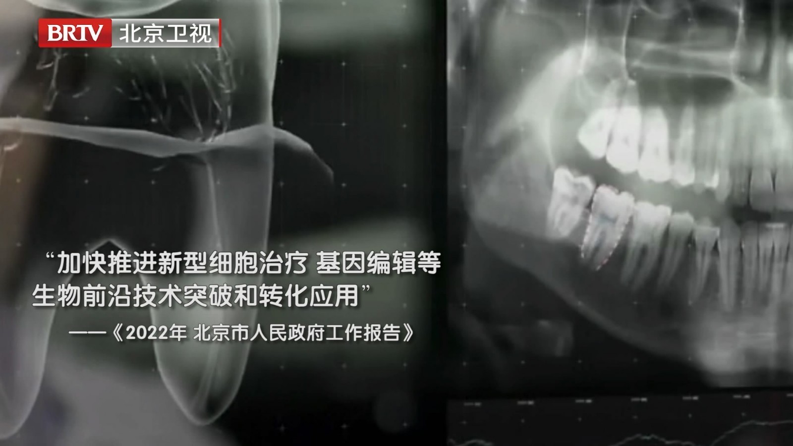 中国研发牙齿再生技术有望让假牙成历史