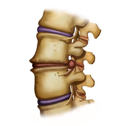 一直信赖西药的我,没想到一味中药处方竟治好