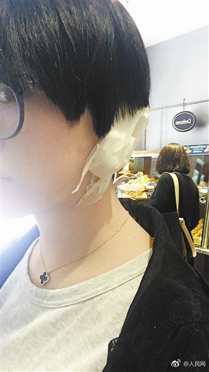 女子理发被剪下耳垂 店员:剪掉很正常