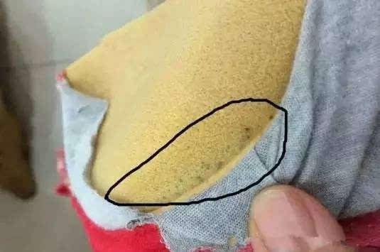 女孩胸部时常瘙痒 剪开内衣的那一刻懵了