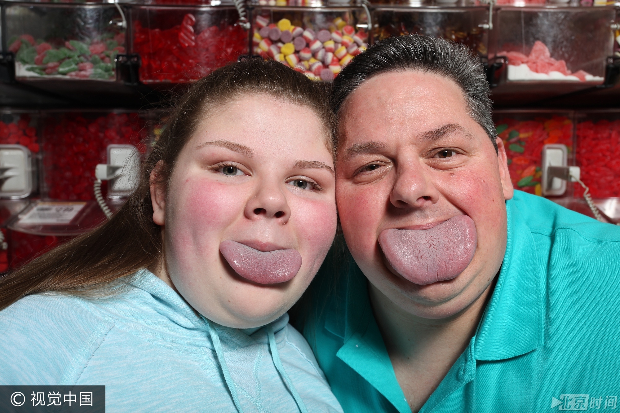 2015年，美国47岁男子拜伦·施伦克尔拥有世界上最宽的舌头，宽达8.3厘米，打破了之前7.9厘米的吉尼斯纪录，他的女儿也不甘示弱舌宽达到7.3厘米。