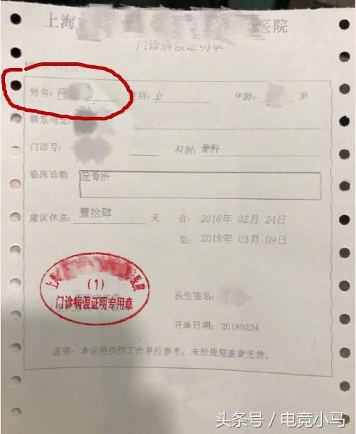 冯提莫骑自行车摔倒,导致脚趾骨折,网友:你的脚