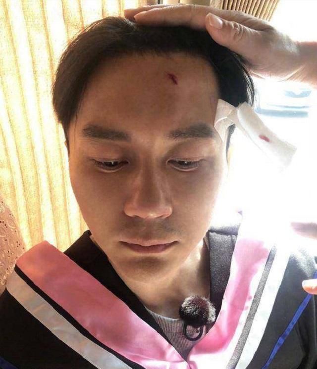 5位参加综艺节目意外受伤的明星,最后一位窒息身亡令人心痛不已