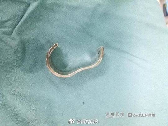 男子用戒指箍住