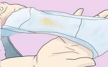 月经都结束了,怎么还有褐色分泌物流出?