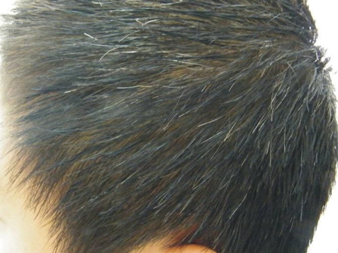 九蒸九晒黑芝麻丸吃一年真的会白发返黑吗?