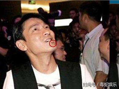 青春偶像俞灏明走出毁容阴影,与赵丽颖合作拍