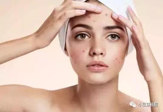 脸上红色痘印发炎怎么办?小豆芽老师教你去除