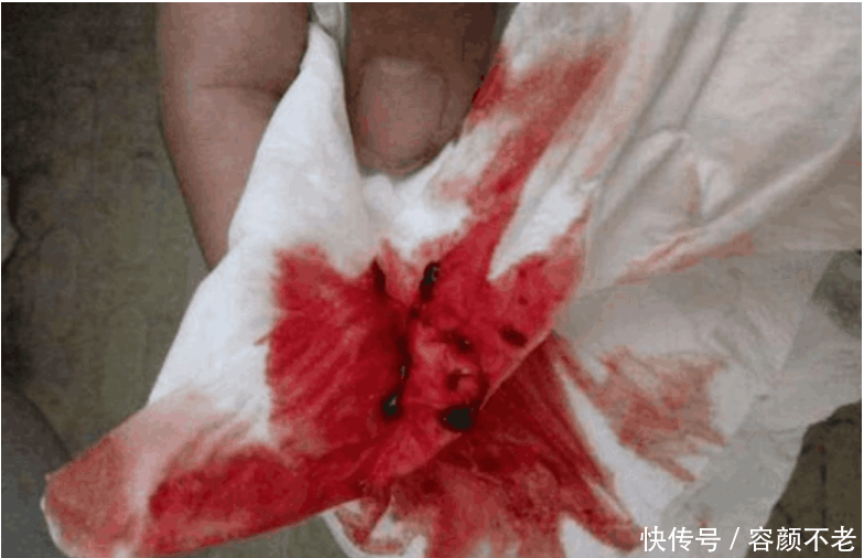 点赞!女同学高考考场上来月经, 裤子都染红了,