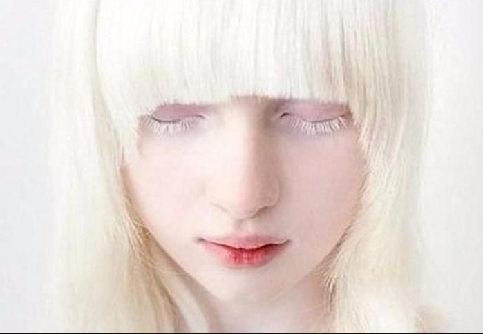 她被称为白雪公主,紫色的瞳孔宛如精灵,但是美的让人心疼