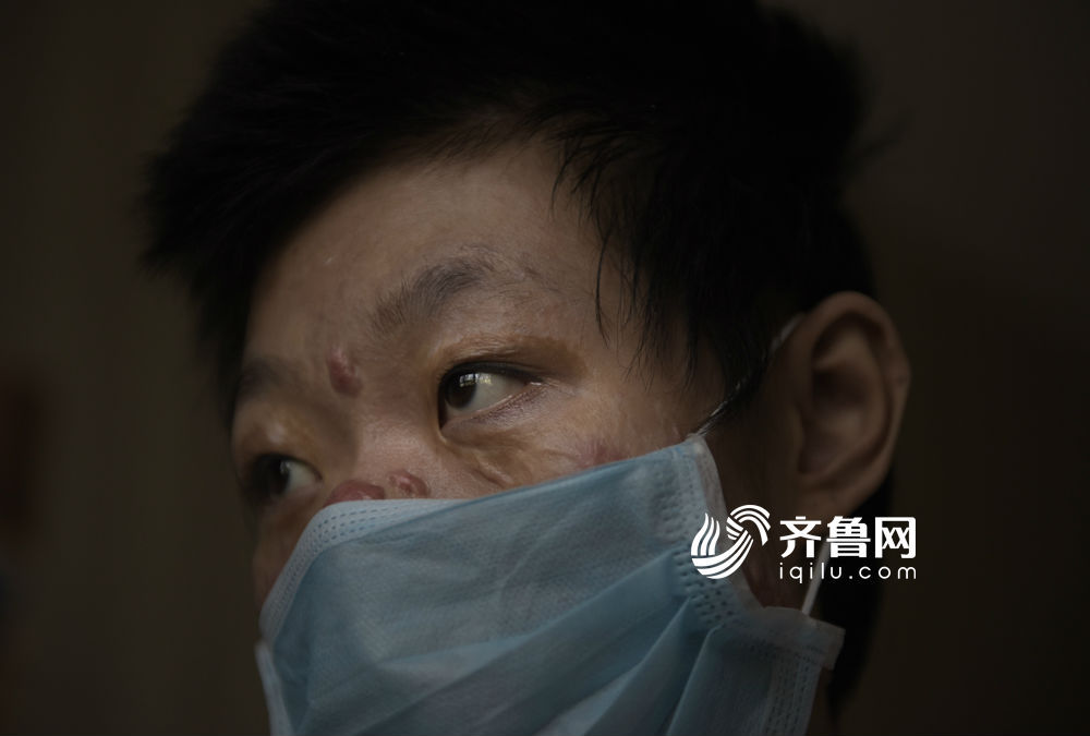 “孩子的毛孔烧没了,一点热气也不能受。”江竹峰说,经过一年多的不间断治疗、手术,她就是想让女儿能活下去。面对记者,平和的情绪下,透露着无法掩饰的哀伤。这个原本幸福的家庭,正在遭受无法被量化的苦与痛。