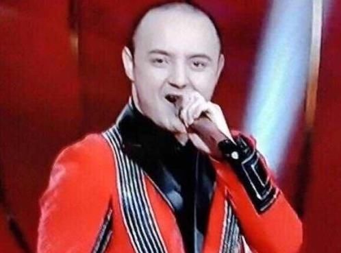 童星阿尔法机智回应秃头照片,向网友咨询生发