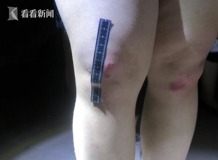 民警还注意到，大多村民一早起来就吃早饭去干农活，这名年轻力壮的男子却在蒙头大睡。办案民警决定先按兵不动，暗中观察男子，并找机会确认男子手臂上是否有明显咬痕。