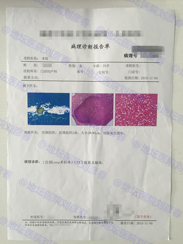 未育女性宫颈锥切后再感染HPV,该怎么办?