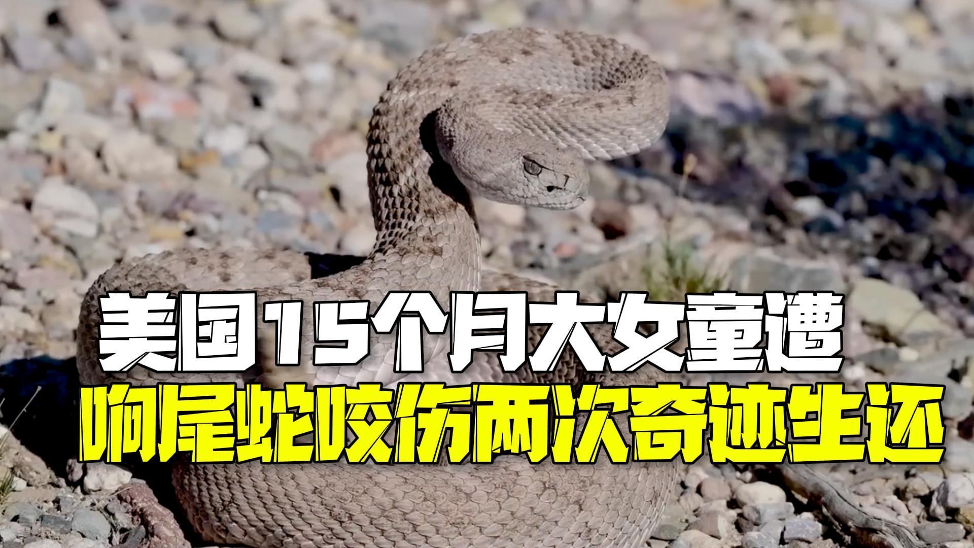 美国15个月大女童后院玩耍遭响尾蛇咬伤两次失去意识 美国15个月大女童后院玩耍遭响尾蛇咬伤两次失去意识